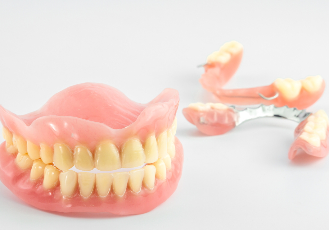 入れ歯(義歯)